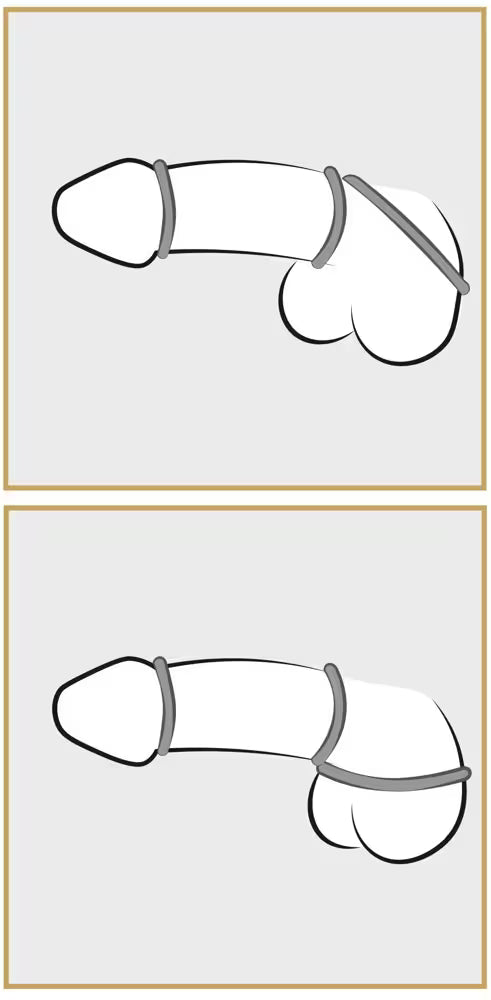 Set anneaux/testicules