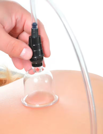 Ventouses de cupping
